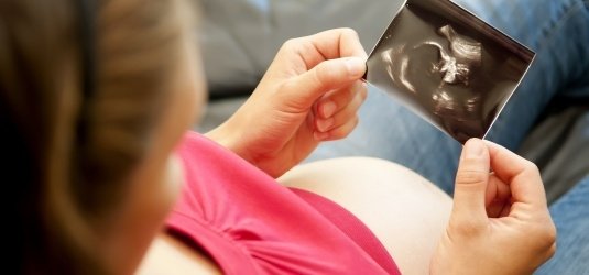 schwangere Frau betrachtet Ultraschallbild
