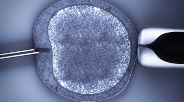 in vitro Fertilisation